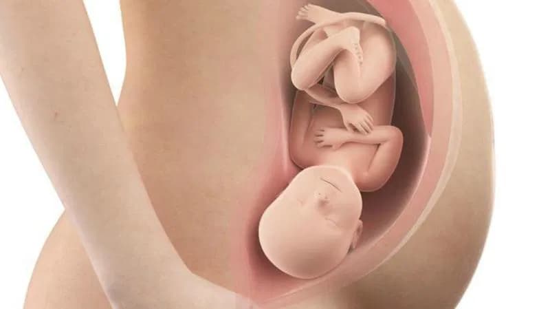东帝汶医院：前3月死胎68例，母婴健康堪忧